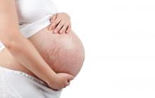 Что делать при беременности, чтобы не было растяжек на животе и груди?